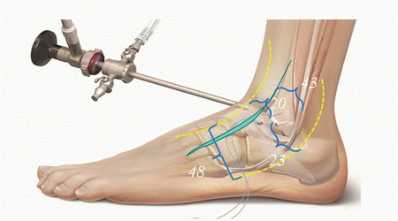 arthroscopy image