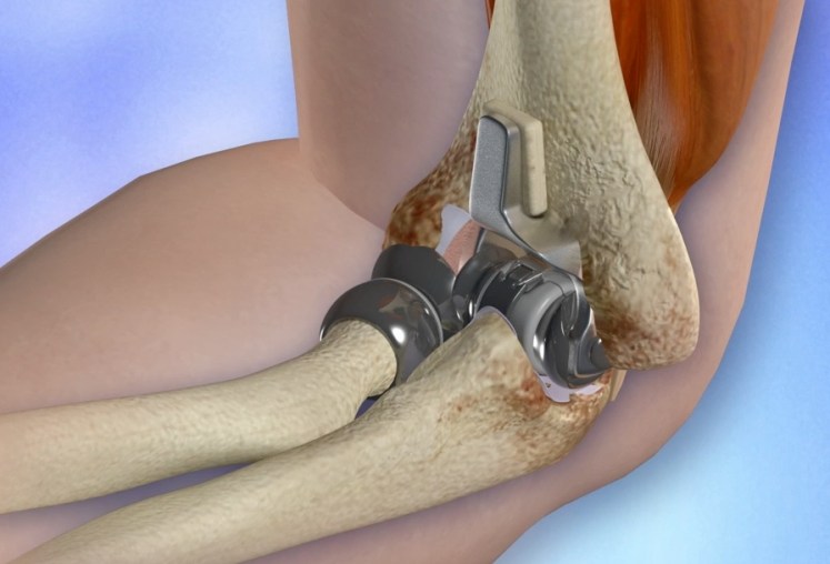 arthroscopy image