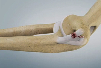 arthroscopy image