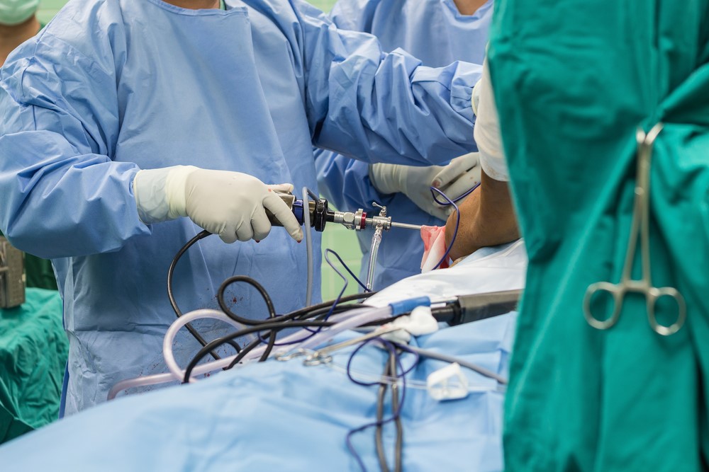 arthroscopy image