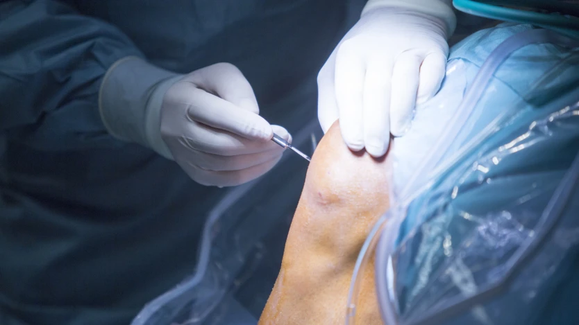 arthroscopy image