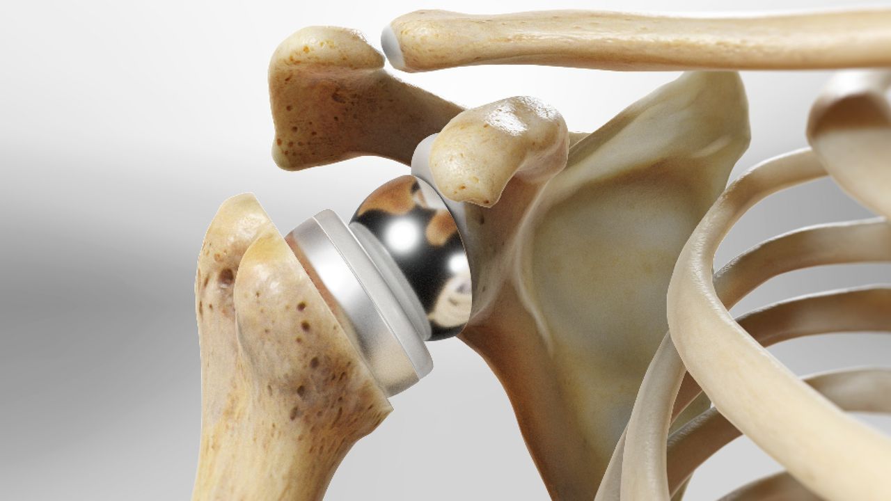 arthroscopy image