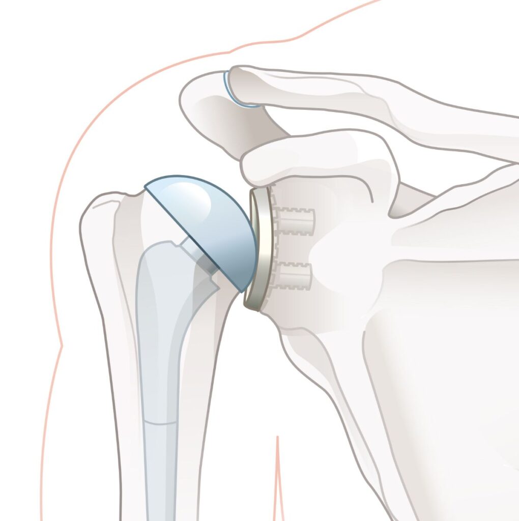 arthroscopy image
