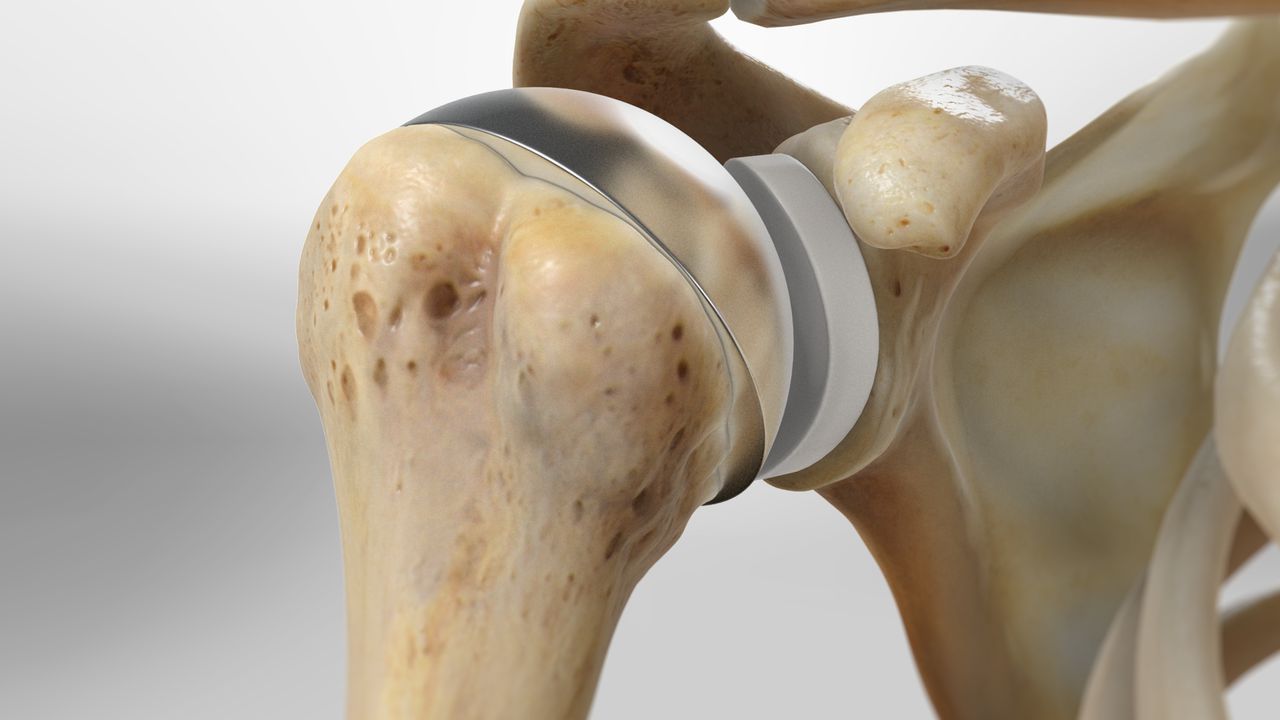 arthroscopy image