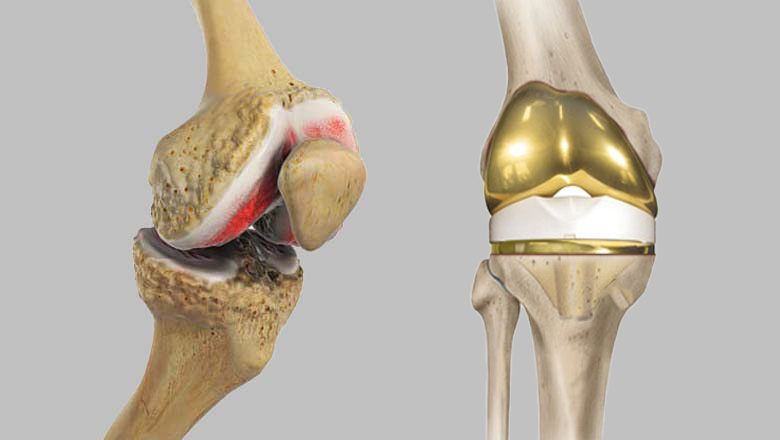 arthroscopy image