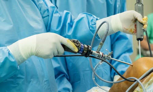 arthroscopy image