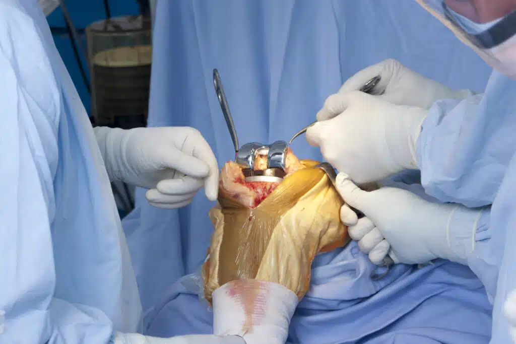 arthroscopy image