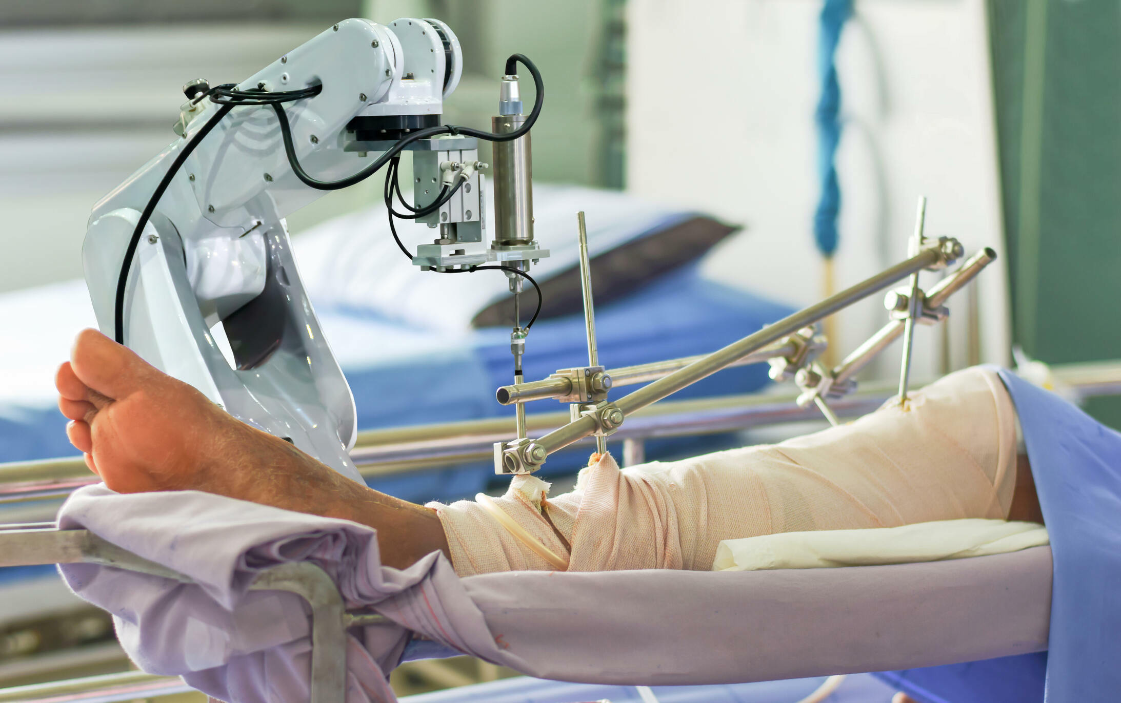 arthroscopy image